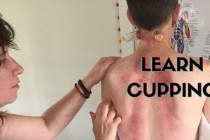 Learn Cupping Banner